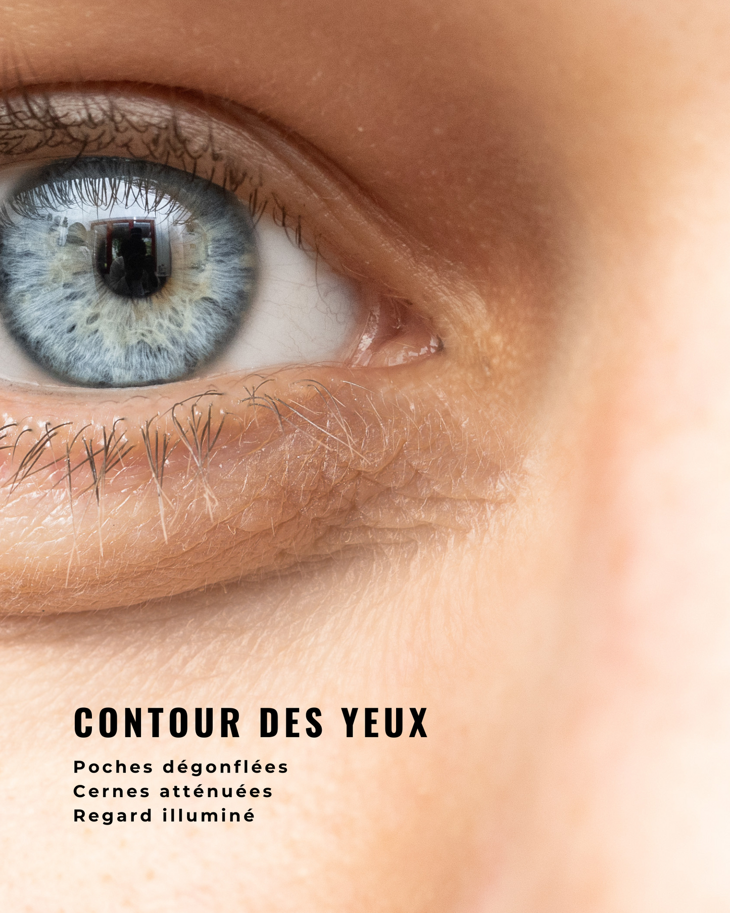 Crème tegen wallen en donkere kringen