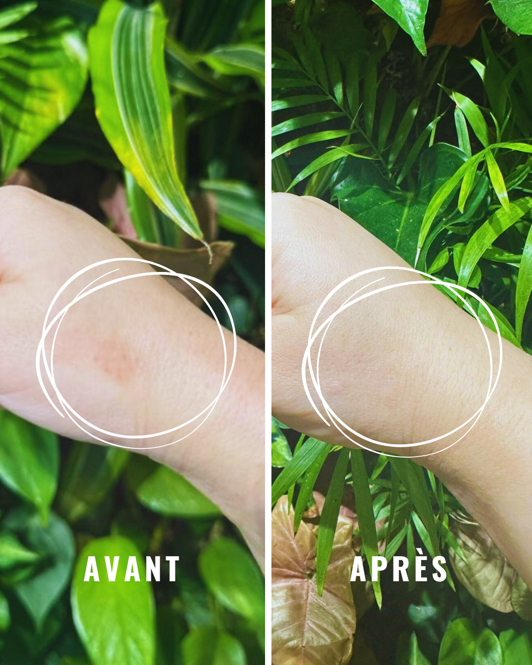 Dermo-herstellende gel