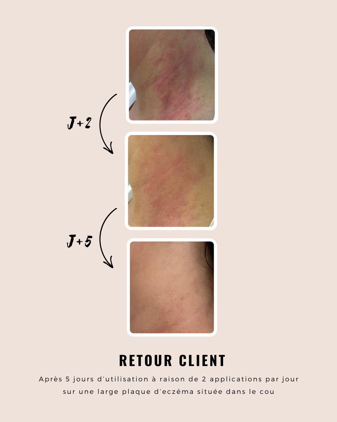 Dermo-herstellende gel