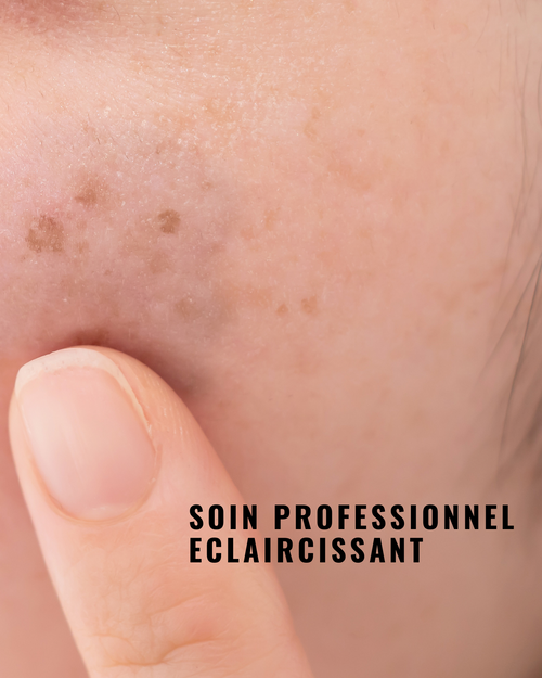 Charger l&#39;image 1 dans la galerie. [PRO] Masque Peel-Off Eclaircissant