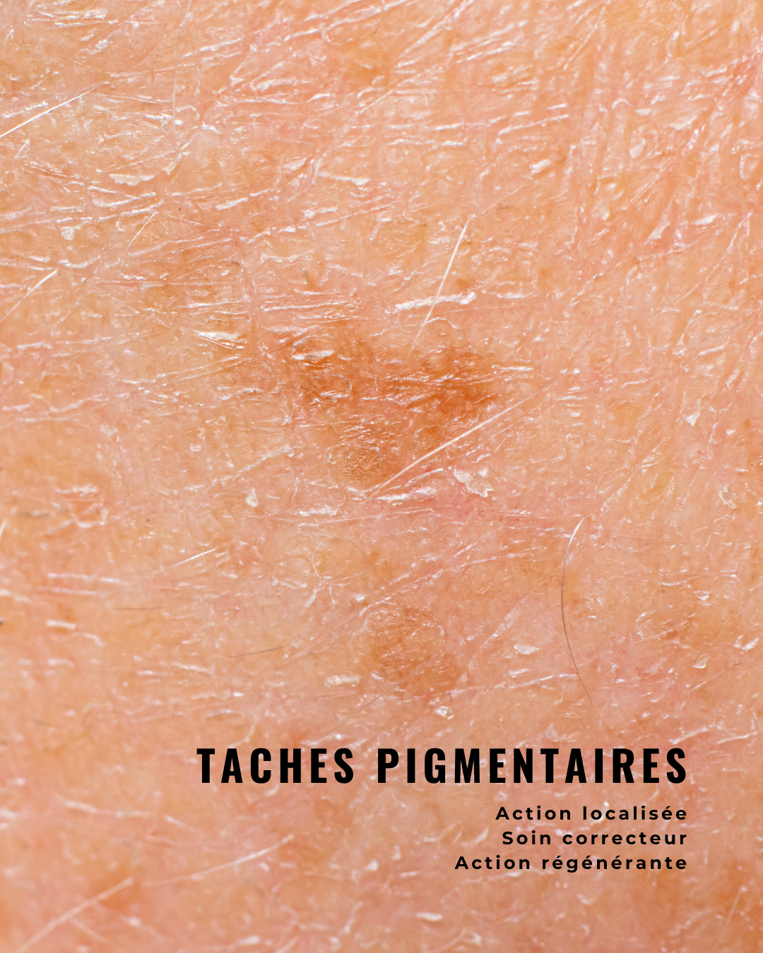 Correcteur Eclaircissant - taches localisées