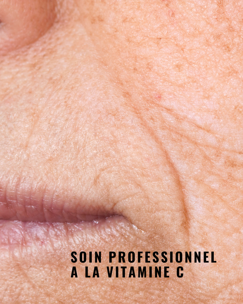 Charger l&#39;image 1 dans la galerie. [PRO] Masque Peel-Off à la Vitamine C - L'Etincelant