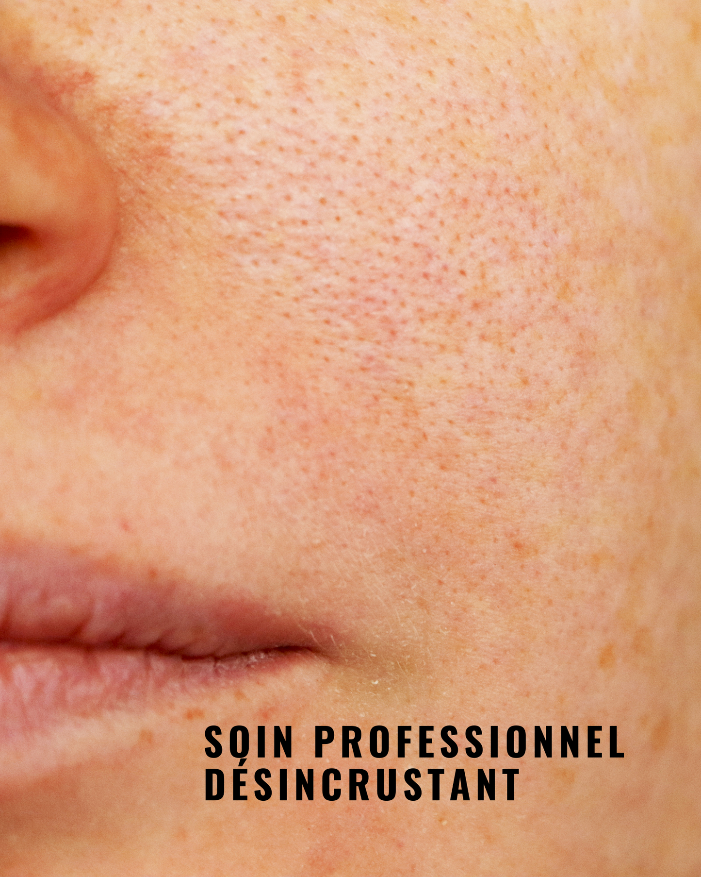 [PRO] Peeling Enzymatique à la Papaye