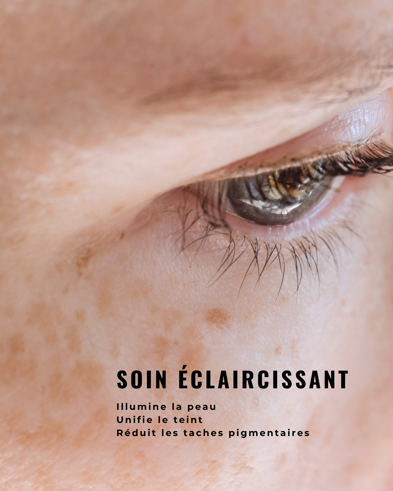 [PRO] Solution Concentrée Eclaircissante