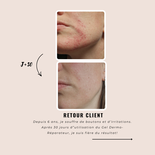 Charger l&#39;image 1 dans la galerie. Gel Dermo-Réparateur