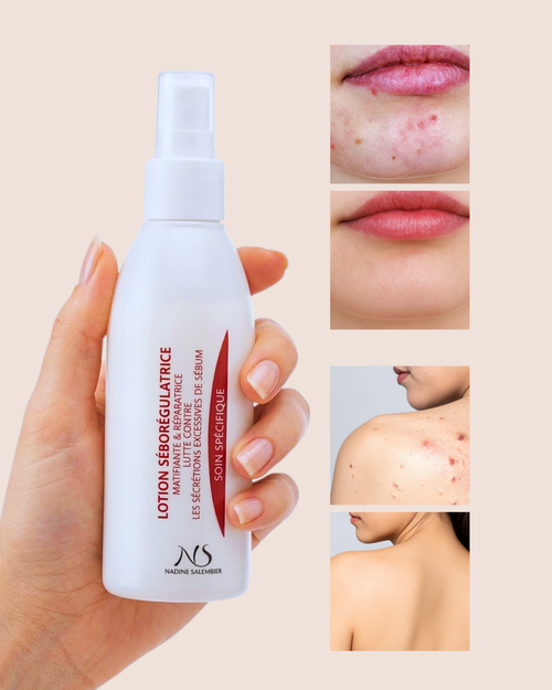 Load image 1 in gallery view. Sebum-Regulating Lotion - Oily and Acne-Prone Skin