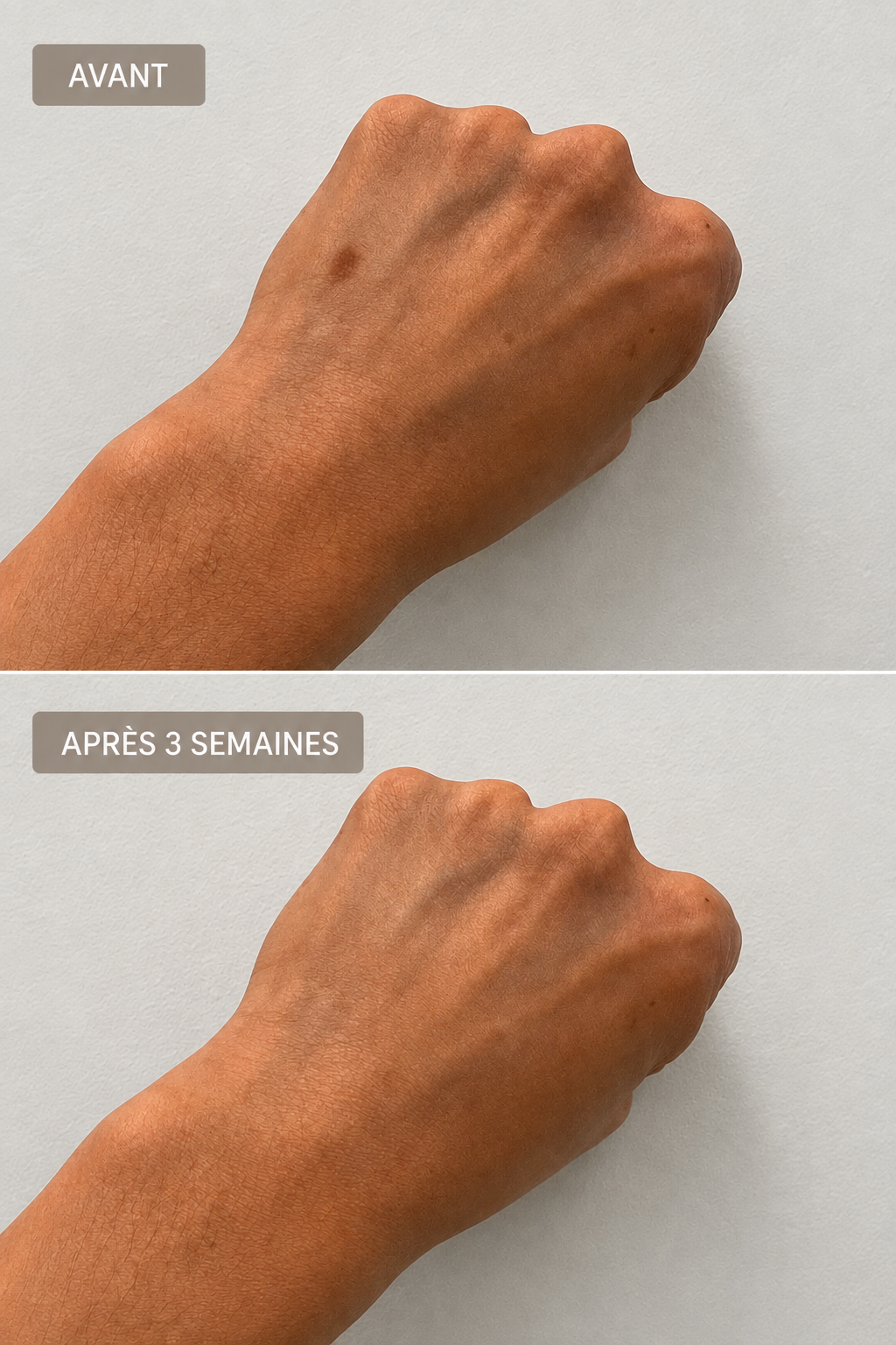 Brightening Corrector - gelokaliseerde vlekken